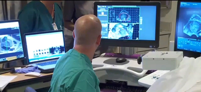 prostate cancer surgery